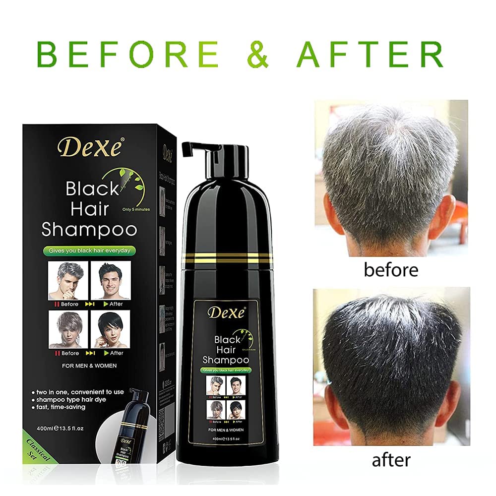 Agthyuve Dexe champú-tinte resultado negro en cabello: canas cubiertas