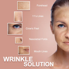 Akissos parches antiarrugas facial promueven una piel suave y luminosa