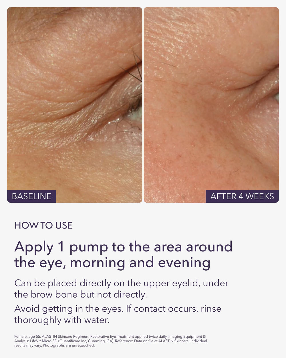 ALASTIN Skincare Restorative Eye Treatment hidratación intensiva para piel delicada alrededor de los ojos.