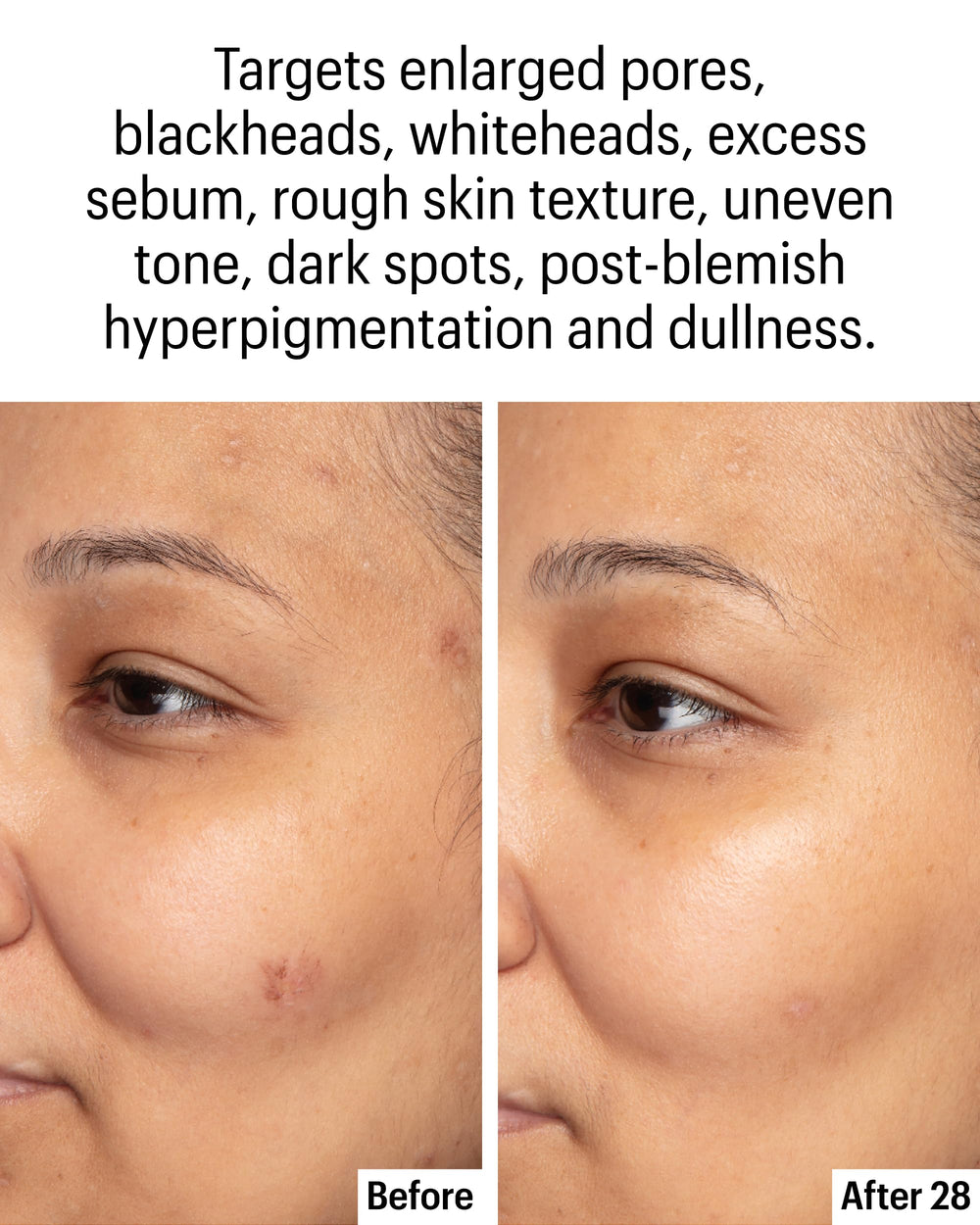 Allies of Skin Kojic Bakuchiol: apaisement et clarté améliorée.