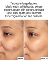 Allies of Skin Kojic Bakuchiol: apaisement et clarté améliorée.