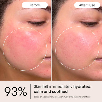 Alpyn Ghostberry, frasco, calma enrojecimiento e irritación en piel sensible.
