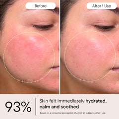 Alpyn Ghostberry, frasco, calma enrojecimiento e irritación en piel sensible.