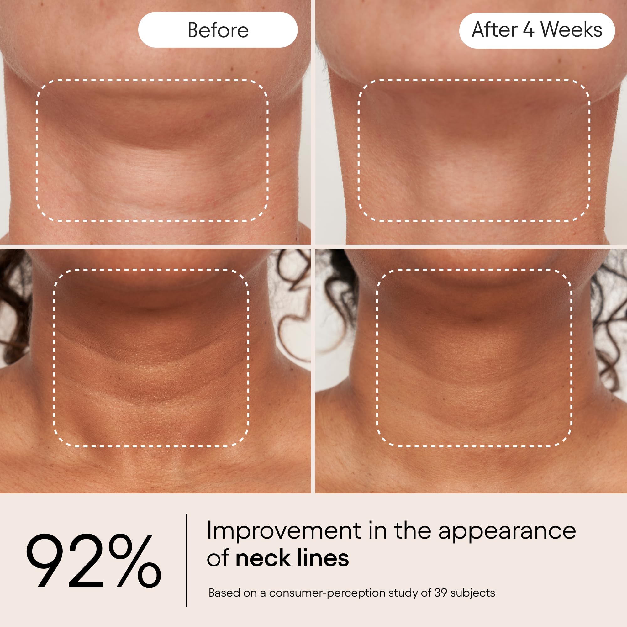 Aplicación en rostro y cuello con ALPYN Super Sculpt Suero para levantamiento suave.