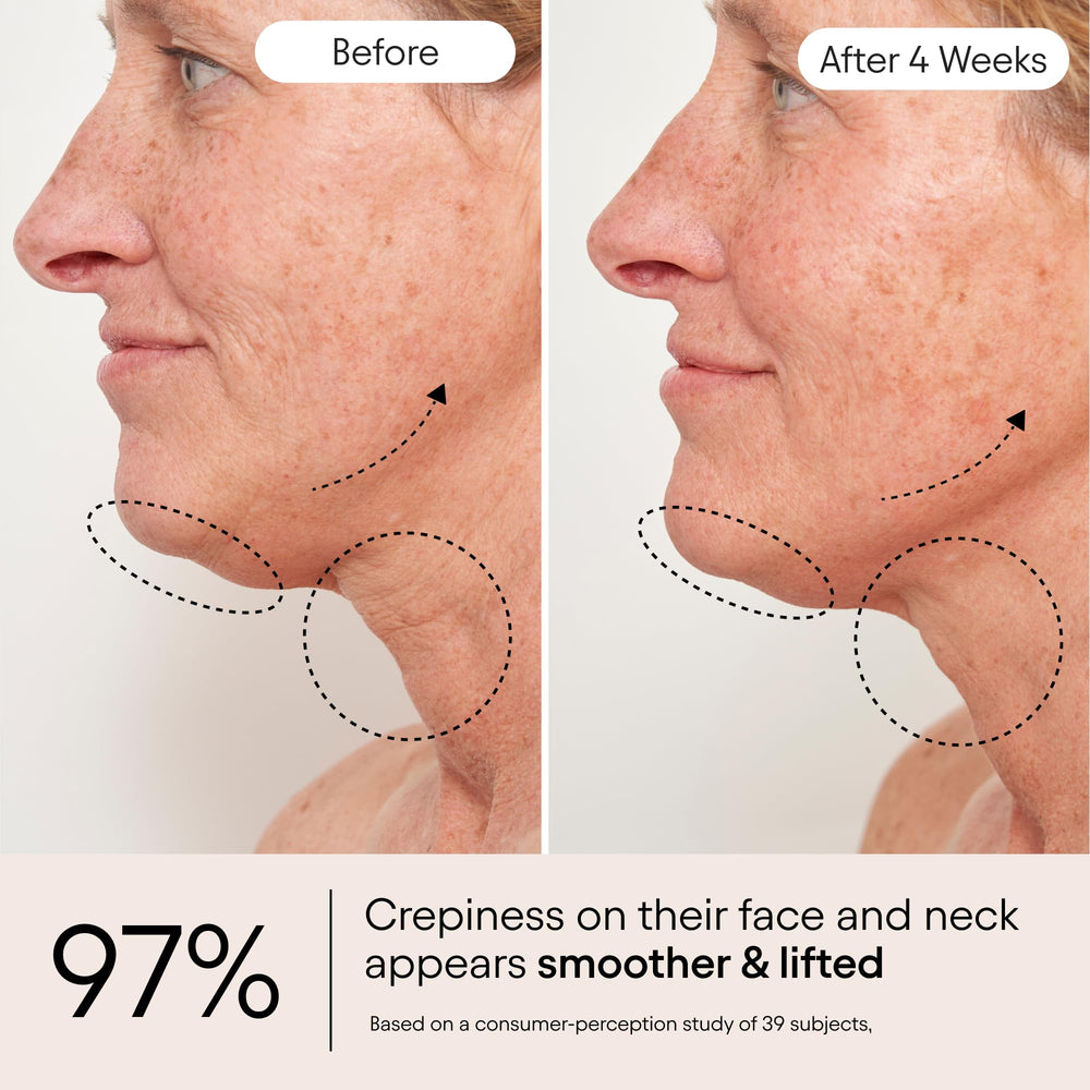 Extracto de manzana en ALPYN Super Sculpt Suero mejora la textura.