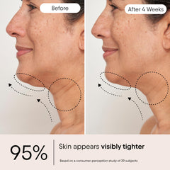 Piel más suave tras usar ALPYN Super Sculpt Suero.