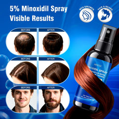 AMRWRIR Minoxidil Spray, masaje suave en la cabeza para mejor absorción.
