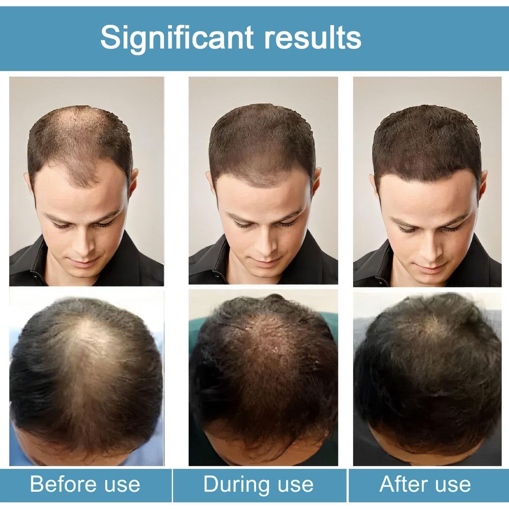 ANEFOSE Sistema de Regeneración Capilar: ingredientes naturales que nutren y fortalecen el cabello.