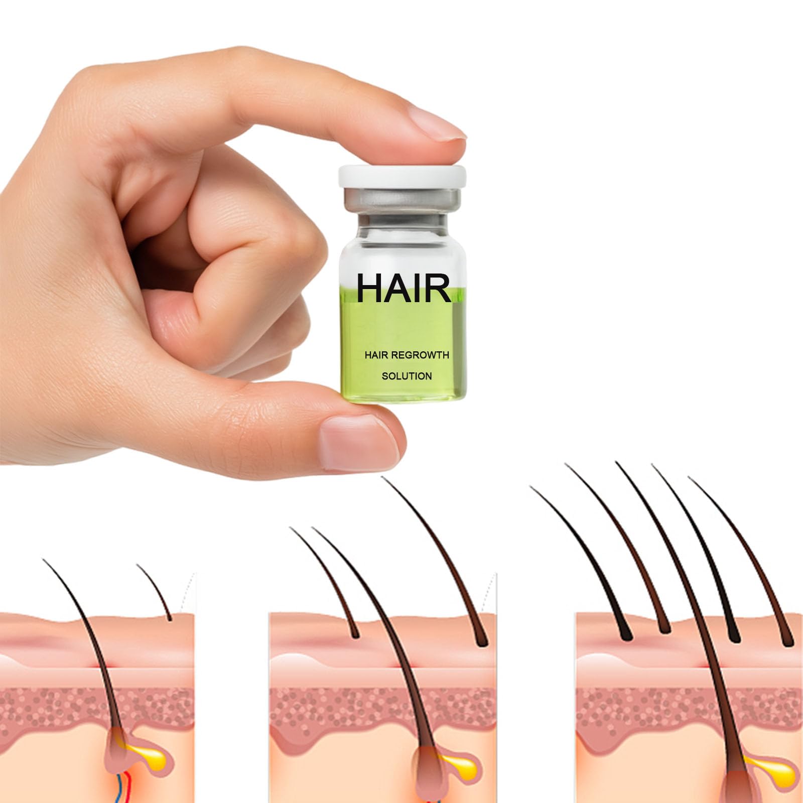ANEFOSE Sistema de Regeneración Capilar: kit completo para potenciar densidad y aspecto saludable del cabello.