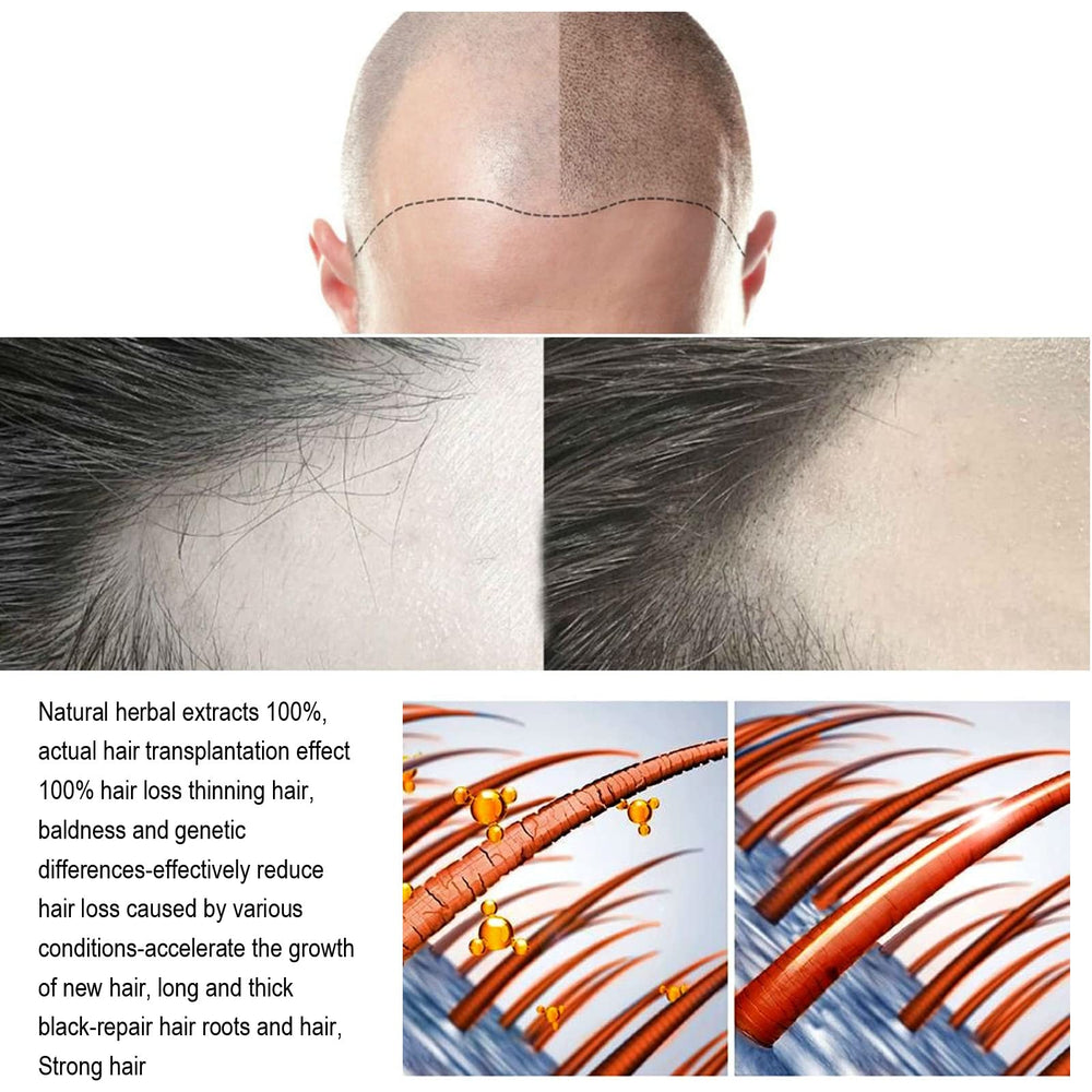 ANEFOSE Sistema de Regeneración Capilar: resultados potenciales, más cuerpo y brillo natural.