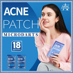 Parche acné rostro AnnaChoice, uso diario para hidratar y apoyar la piel.