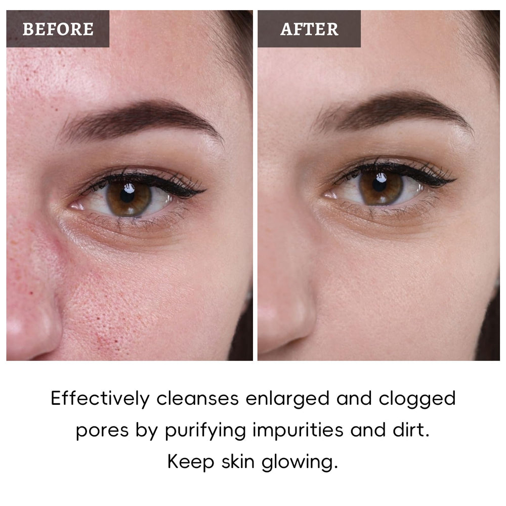 ANRCOLLECT textura-aplicacion-suave: muestra una aplicación suave de cada mascarilla.