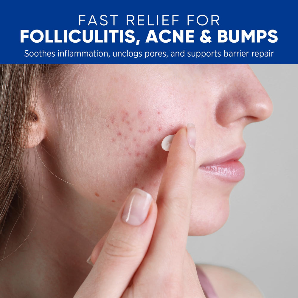 Textura ligera de AOSORW crema foliculitis para absorción rápida