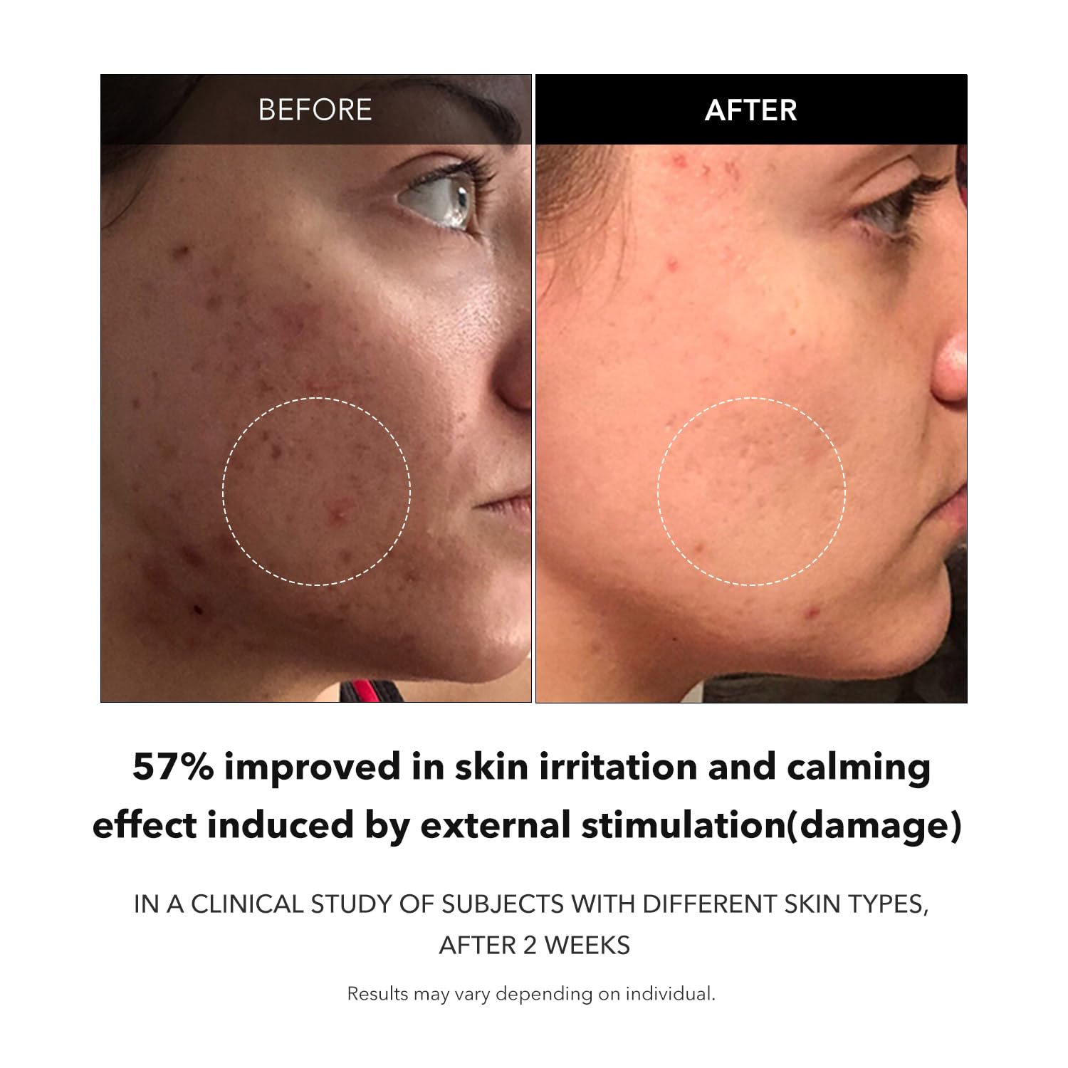 APRILSKIN Carrotene con ácido hialurónico para hidratación profunda.