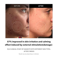 APRILSKIN Carrotene con ácido hialurónico para hidratación profunda.