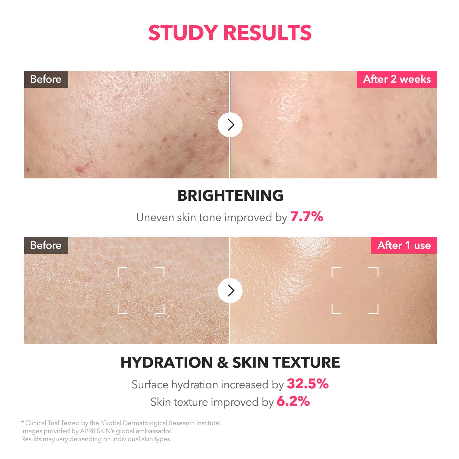 APRILSKIN Fórmulas con Panthenol y ácido hialurónico para hidratación intensa.