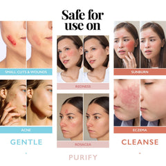 Aquia antiacné cuidado facial, ayuda a limpiar piel sensible