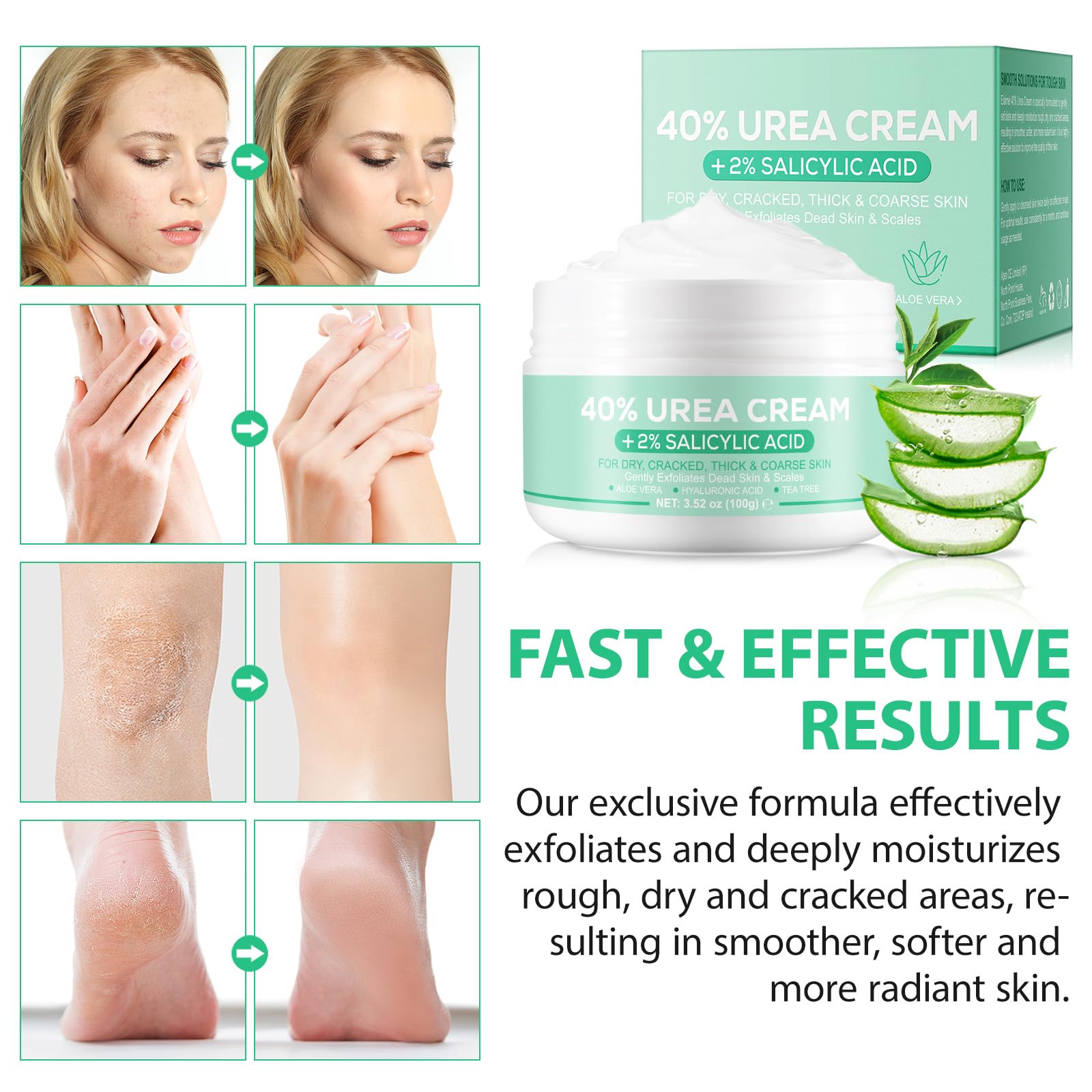 ARBCRN crema de urea 40% uso multifuncional para pies y manos.