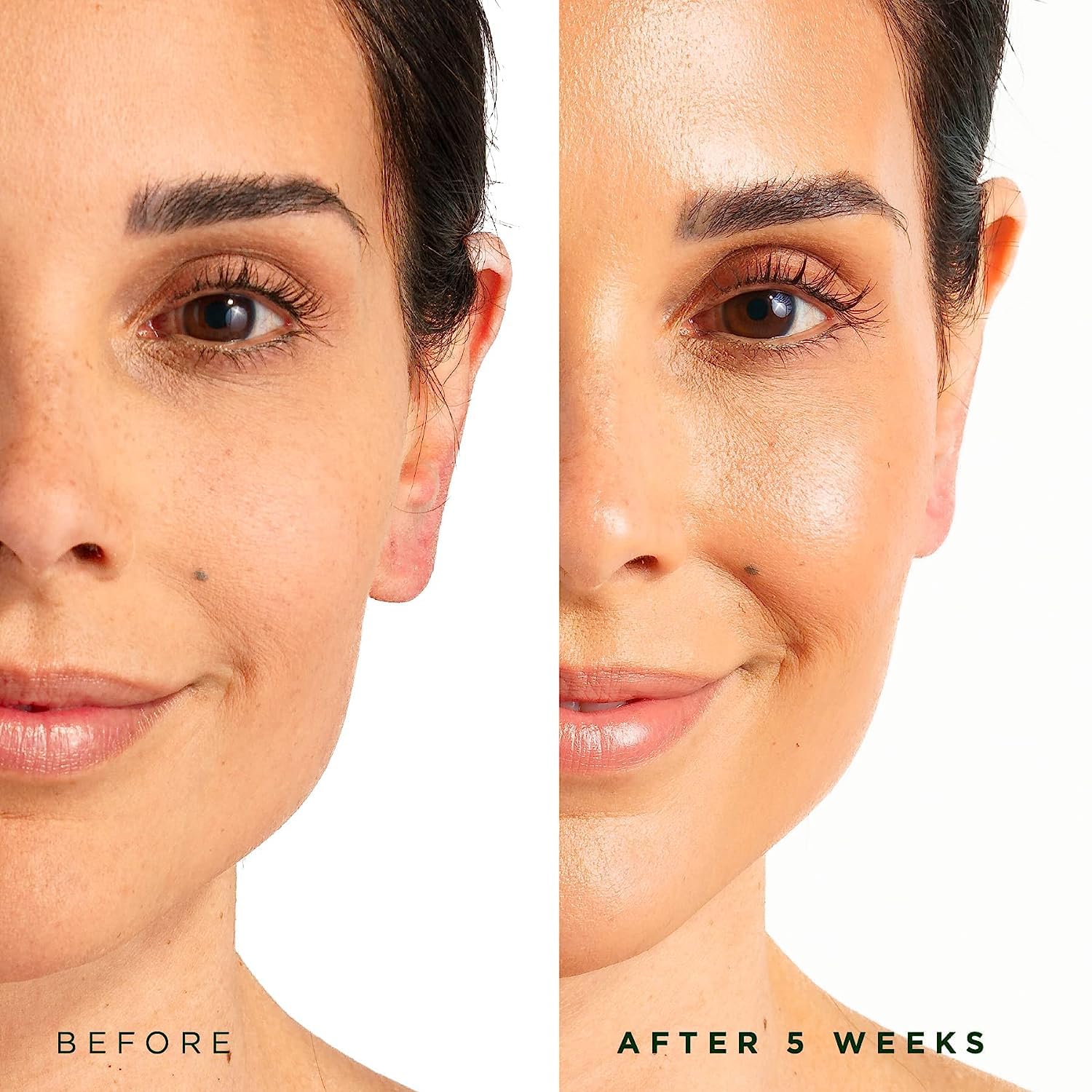 Aplicación diaria de 3–5 gotas para rostro y cuello con Serum Árbol de la Vida.