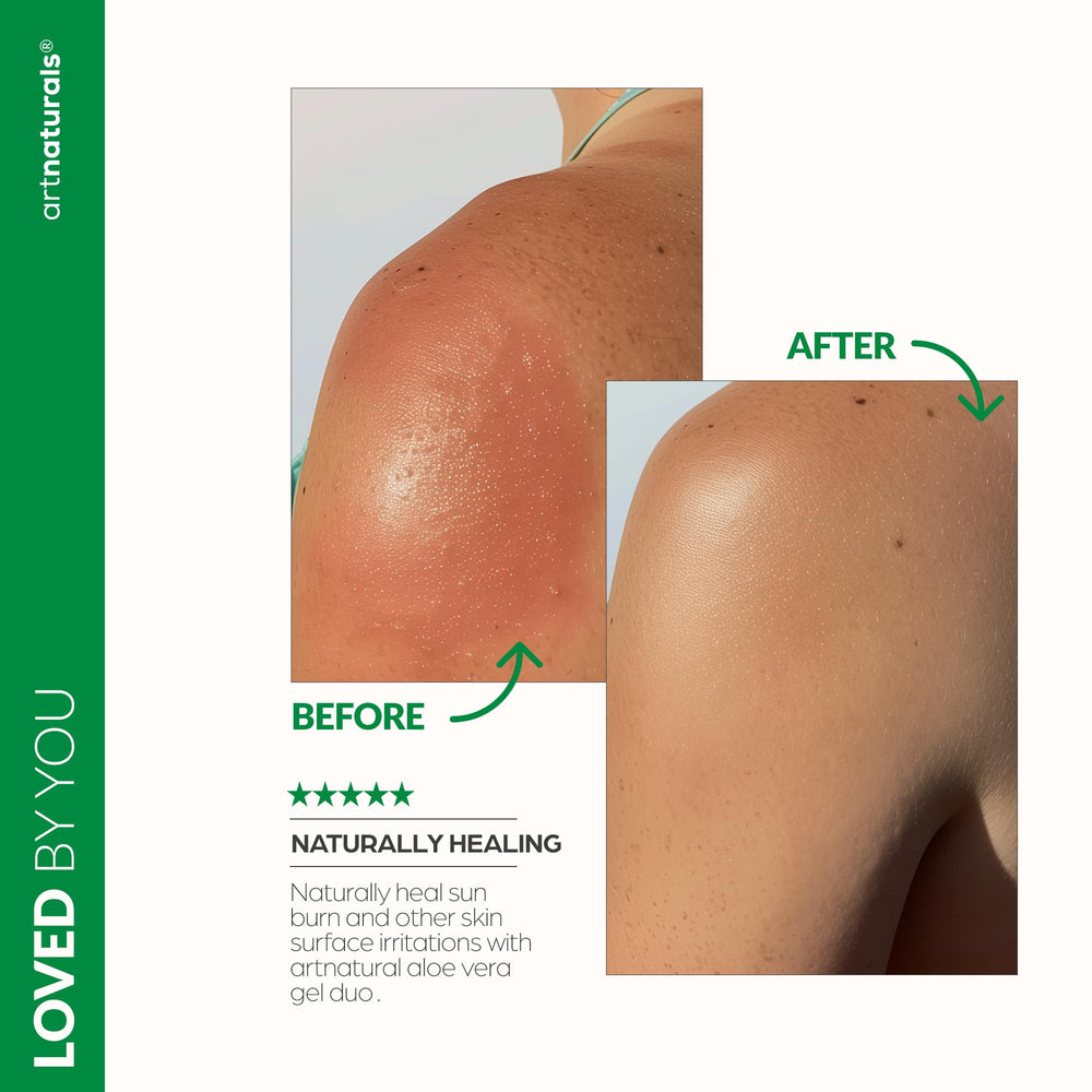 Artnaturals Aloe Vera Gel Set ideal para rostro y cuerpo hidratados.