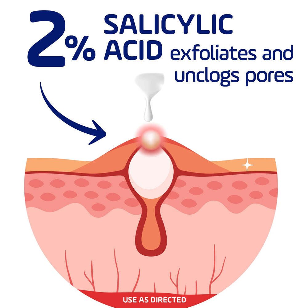 Asepxia 2% salicylic acid cream close-up.