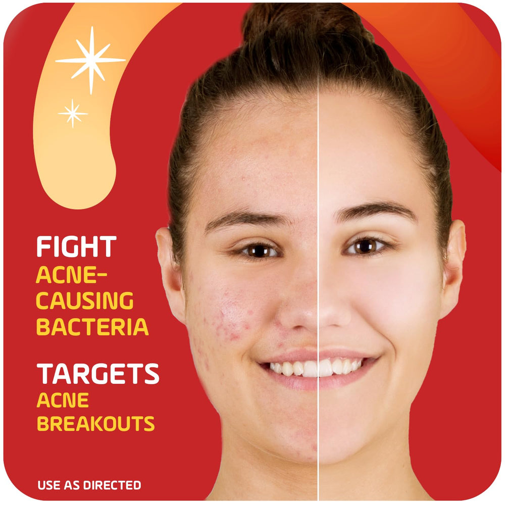 Compact 1oz packaging of Asepxia cream ideal for travel.