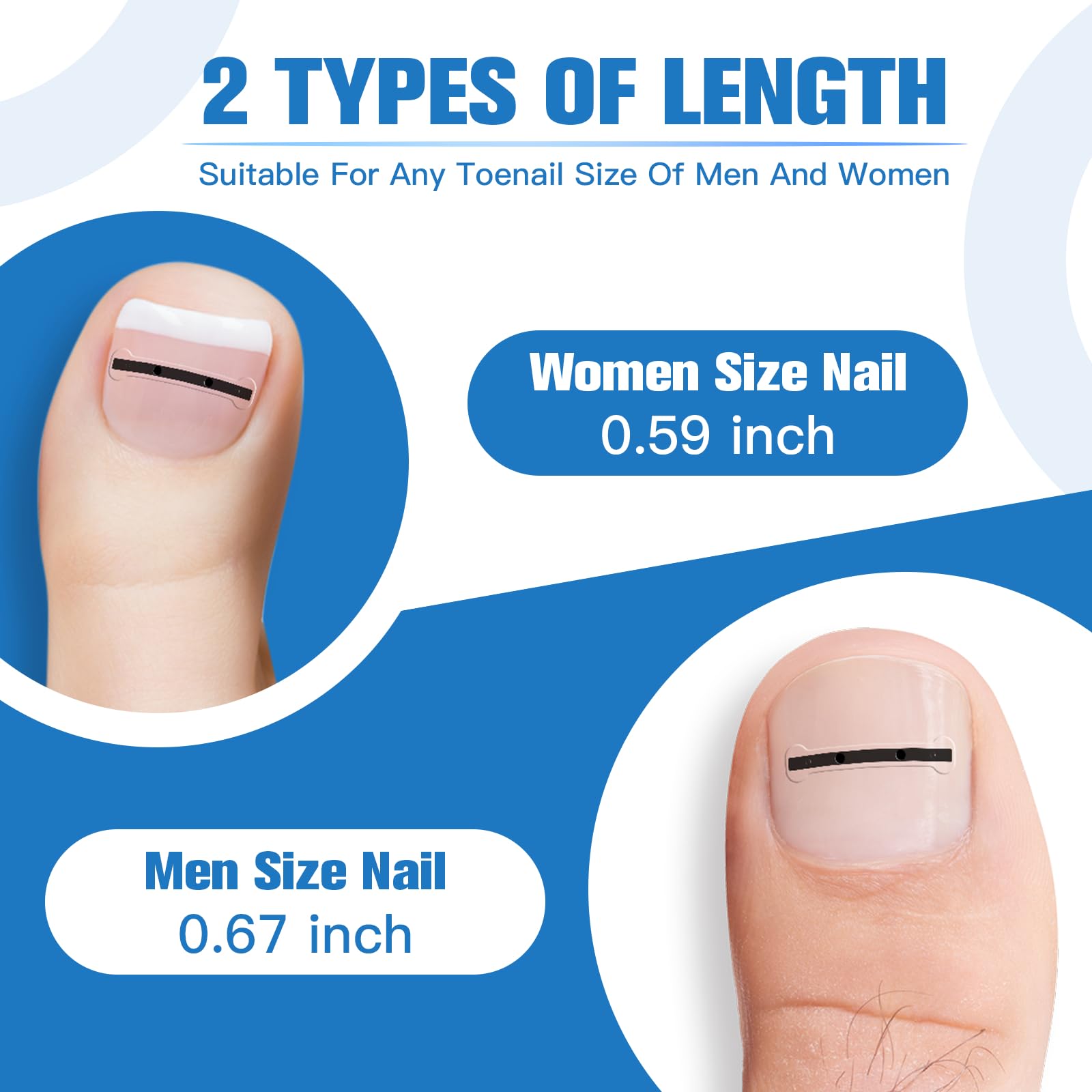 Asinkiher correcteur ongles incarnes flexible et résilient, sans déformation.