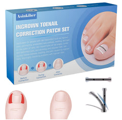 Asinkiher traitement ongles incarnes alliage titane, correction précise et durable.