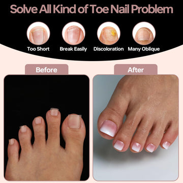 ASONRL Gel X Tips material ABS acrílico, duradero y seguro.