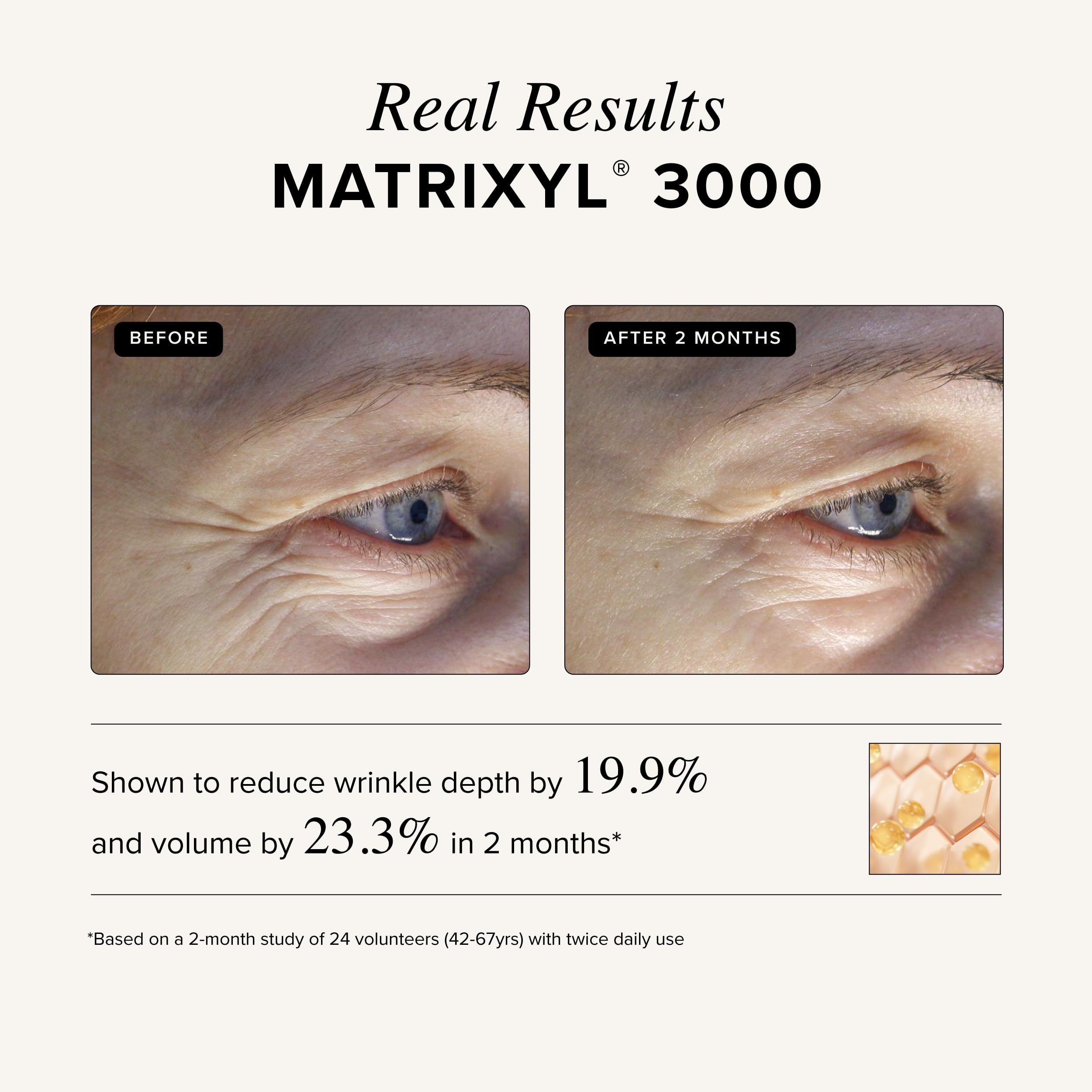 Asterwood Matrixyl 3000, piel suave tras la aplicación.