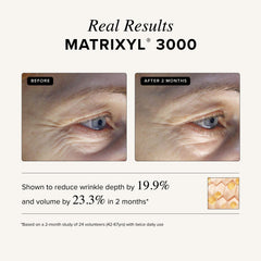 Asterwood Matrixyl 3000, piel suave tras la aplicación.