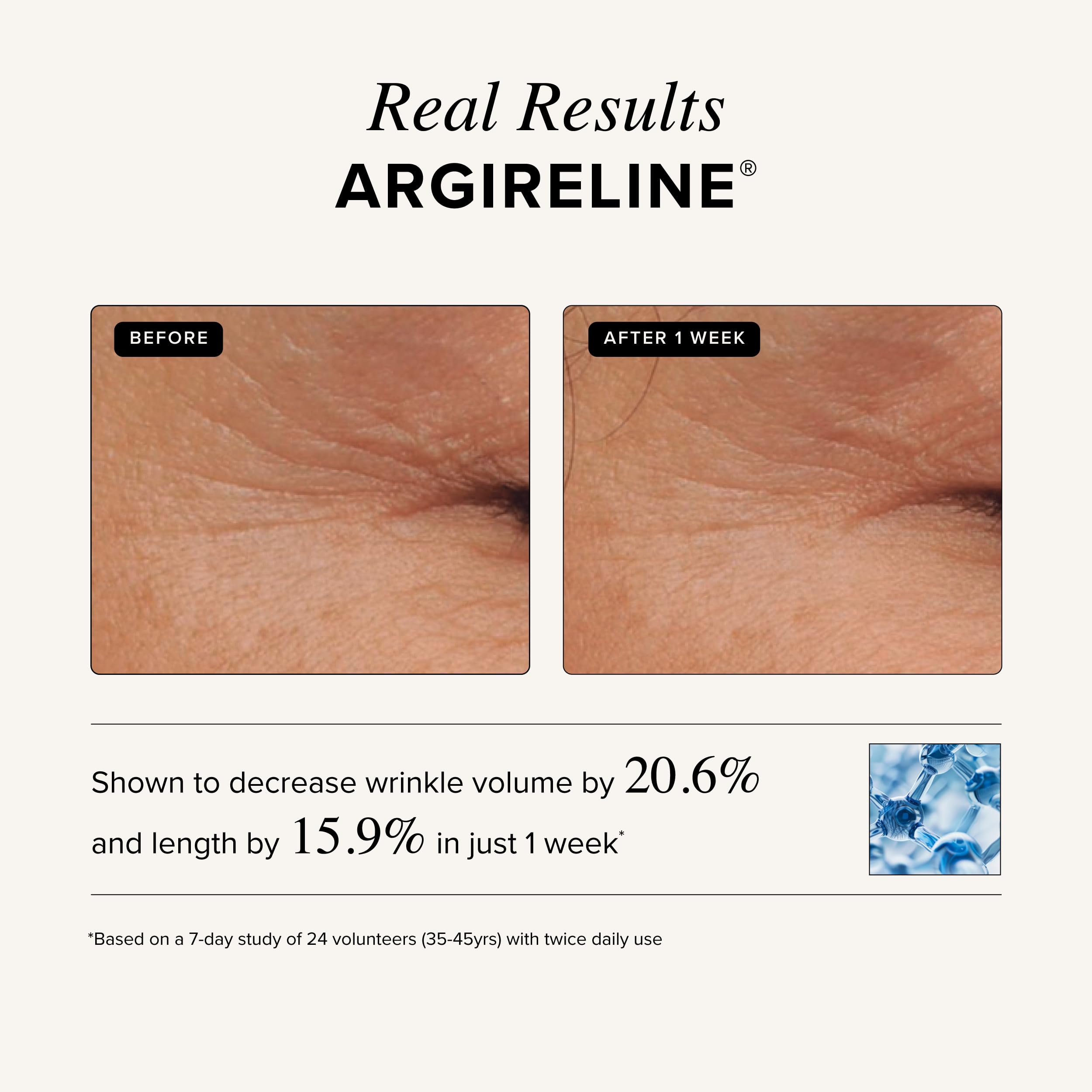 Asterwood Matrixyl 3000 + Argireline: ideal para piel sensible sin irritantes.