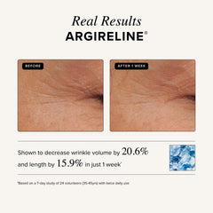Asterwood Matrixyl 3000 + Argireline: ideal para piel sensible sin irritantes.