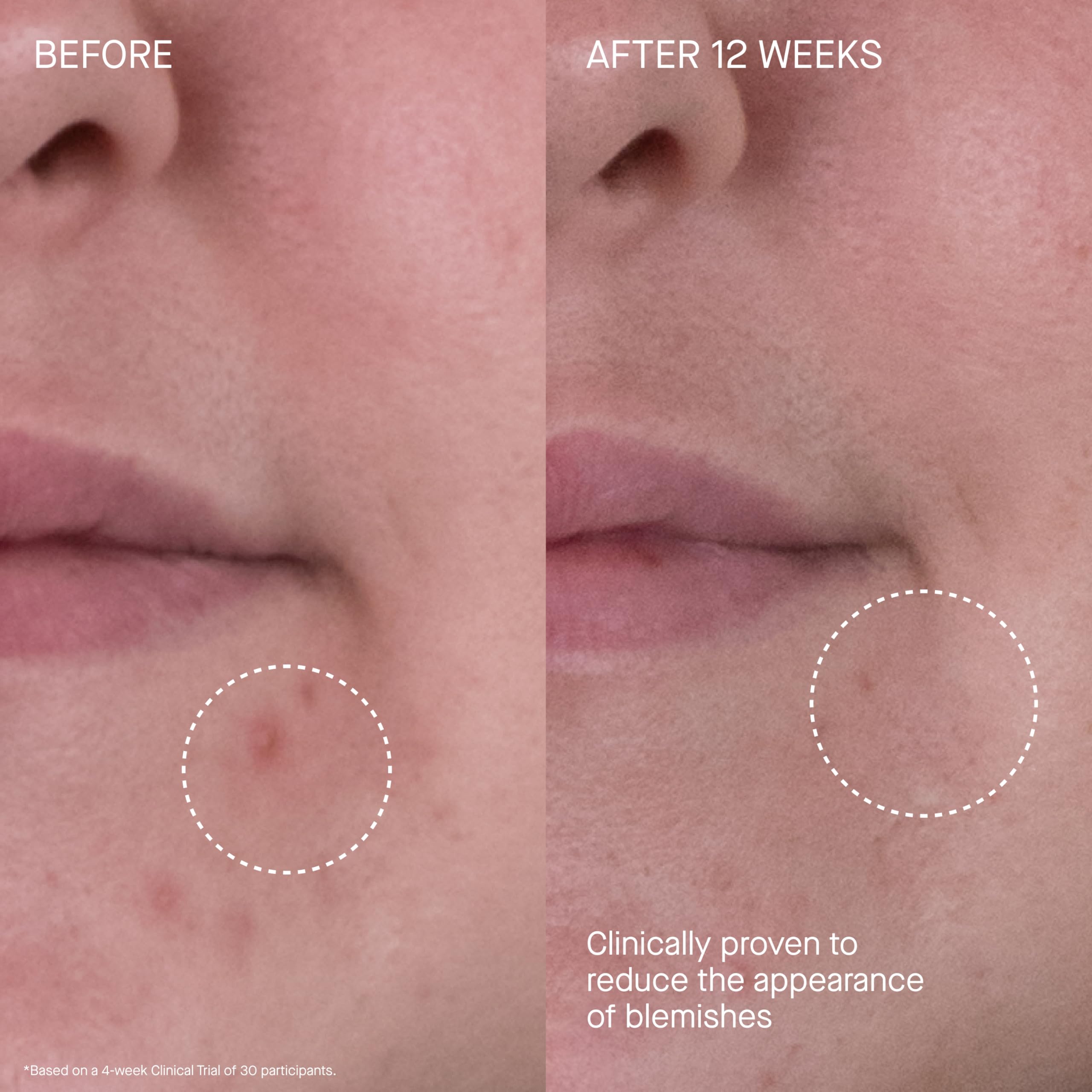 Cuidado cuello y décolleté con Rich Cream para nutrición localizada