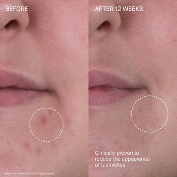 Cuidado cuello y décolleté con Rich Cream para nutrición localizada