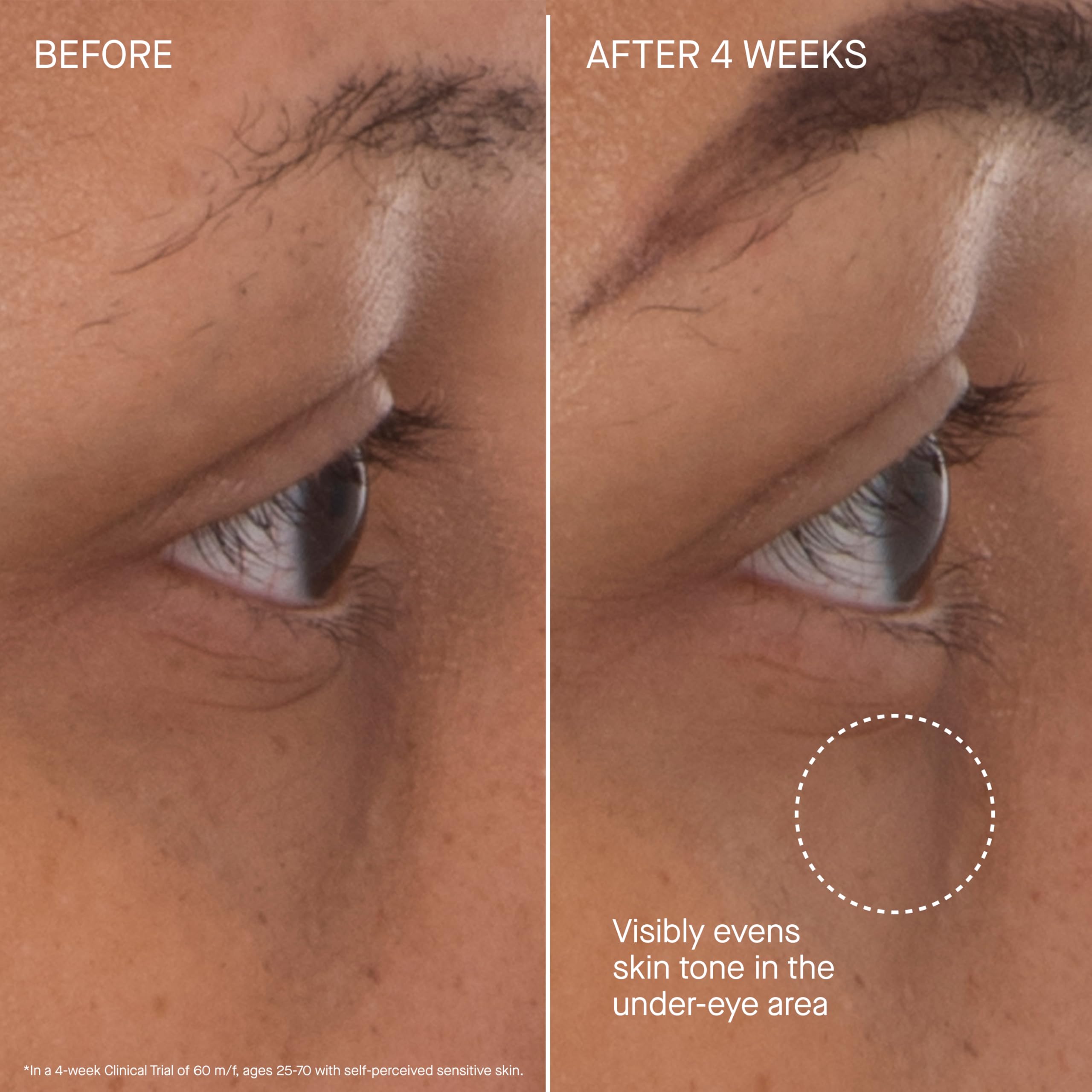 Parche de ojos Augustinus Bader sin fragancia para piel sensible.