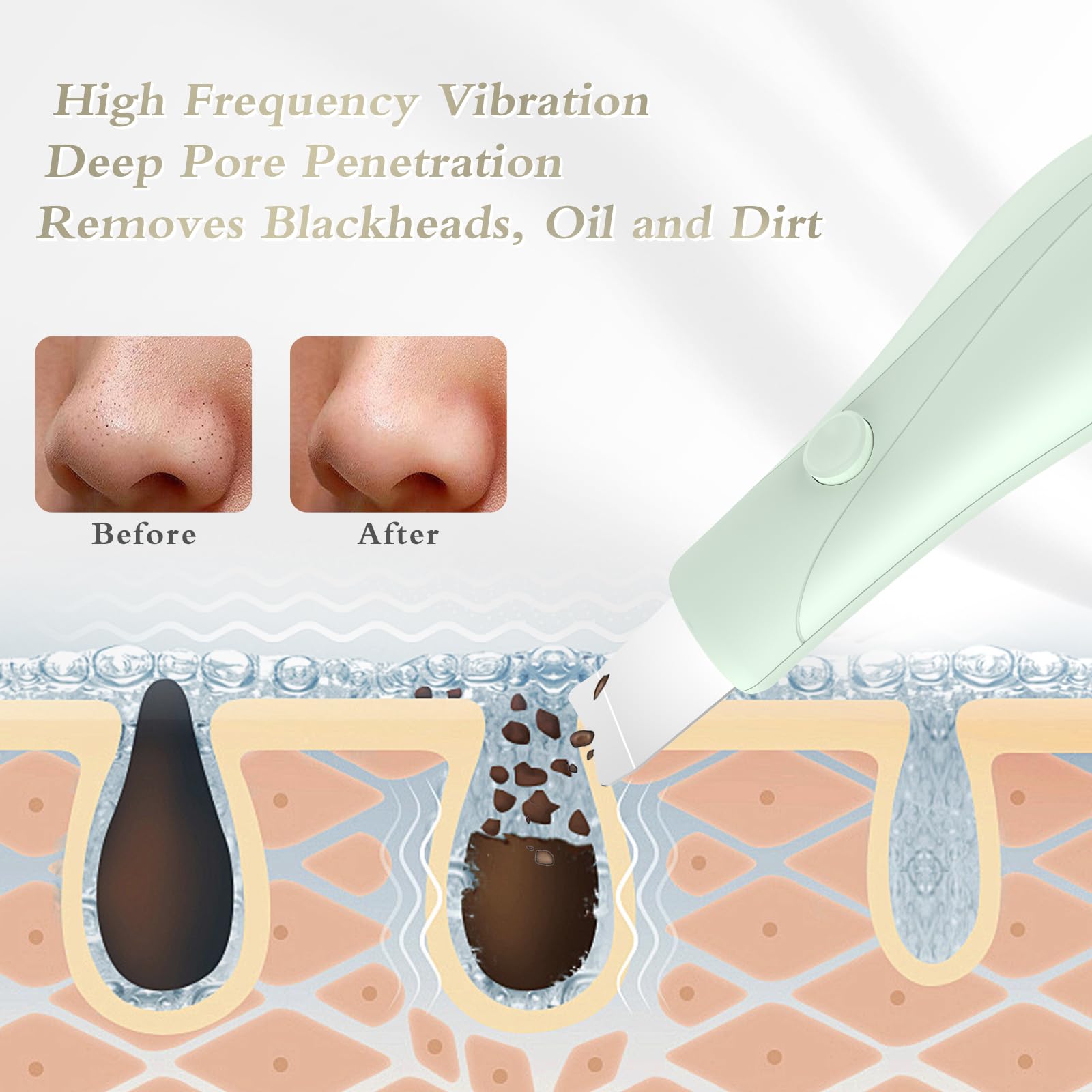 Cabezal suave de Auioytoy para puntos negros, exfoliación delicada sin irritación.