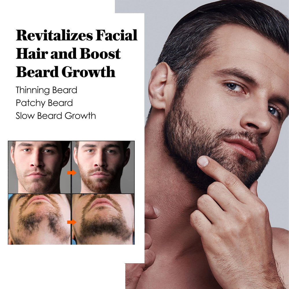 AVITAPURE aplicando minoxidil en la barba para absorción suave.