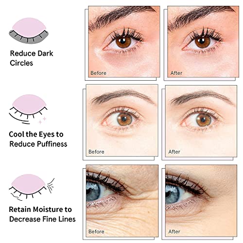AVJONE parches ojos hidratación intensa para piel cansada