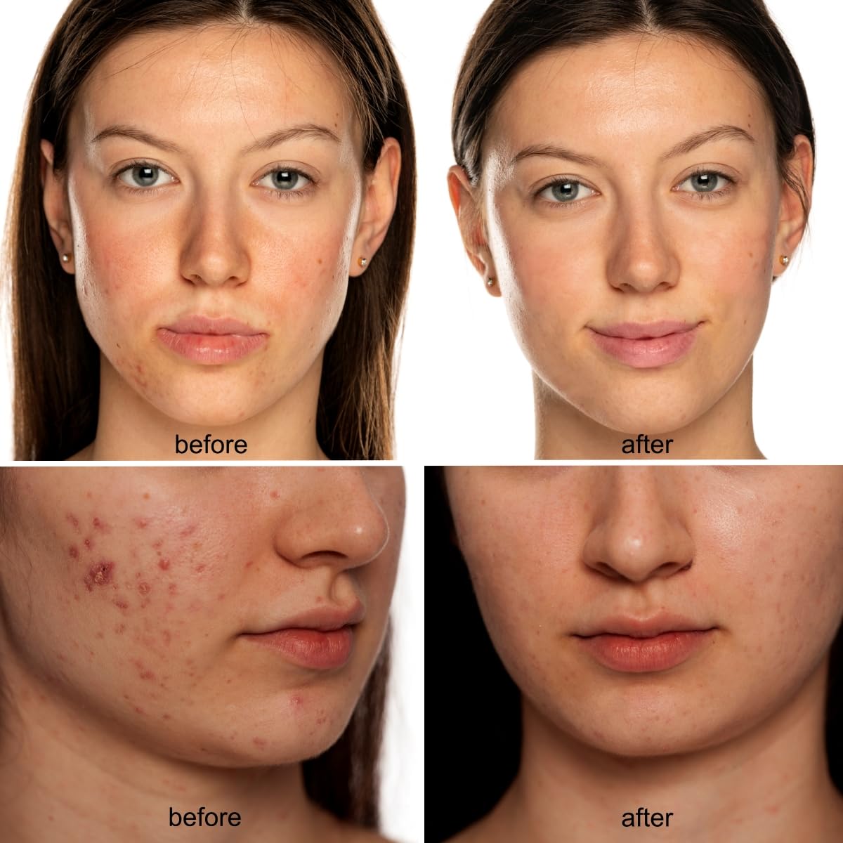 Avorla Beauty LED Mask luz multi longitudes de onda para piel versátil.