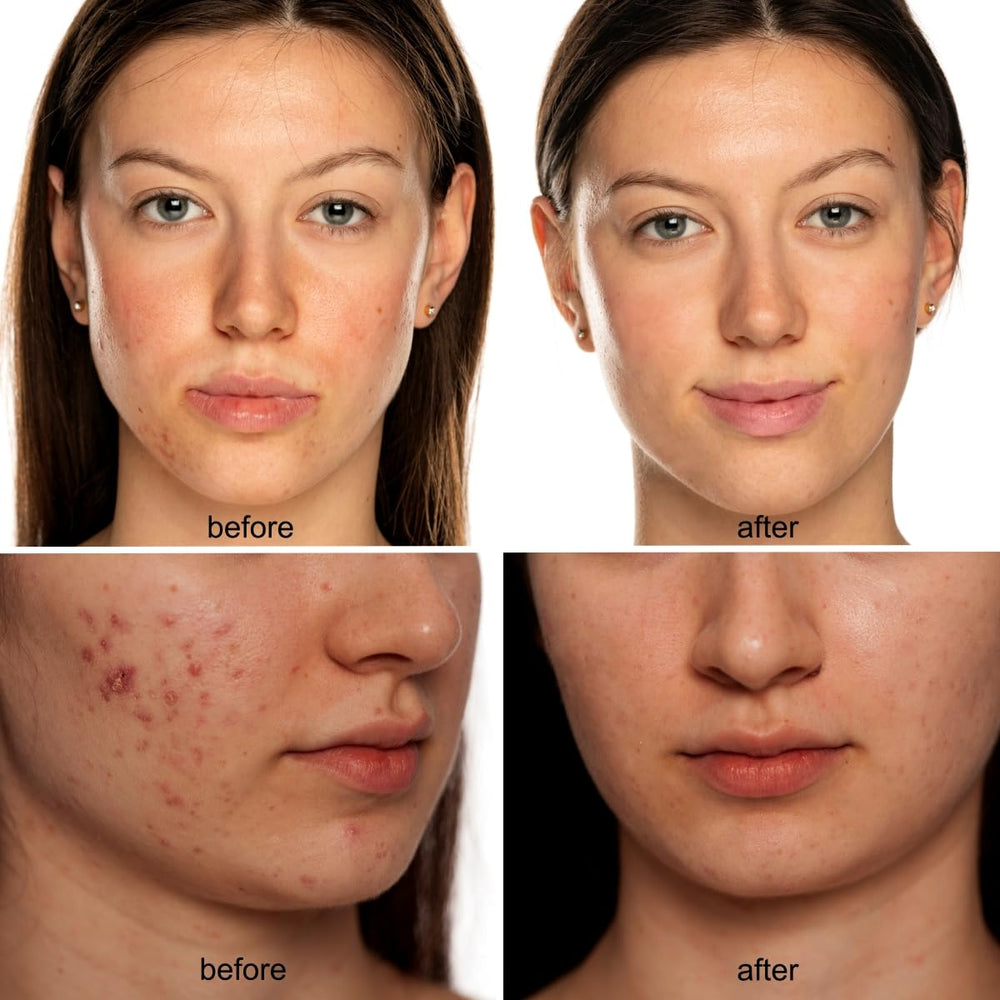 Avorla Beauty LED Mask luz multi longitudes de onda para piel versátil.