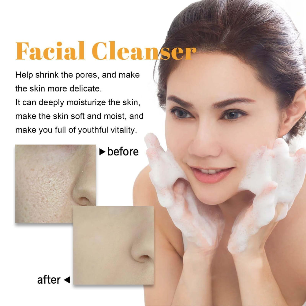 Cepillo de limpieza facial Axnzp para exfoliar y masajear la piel