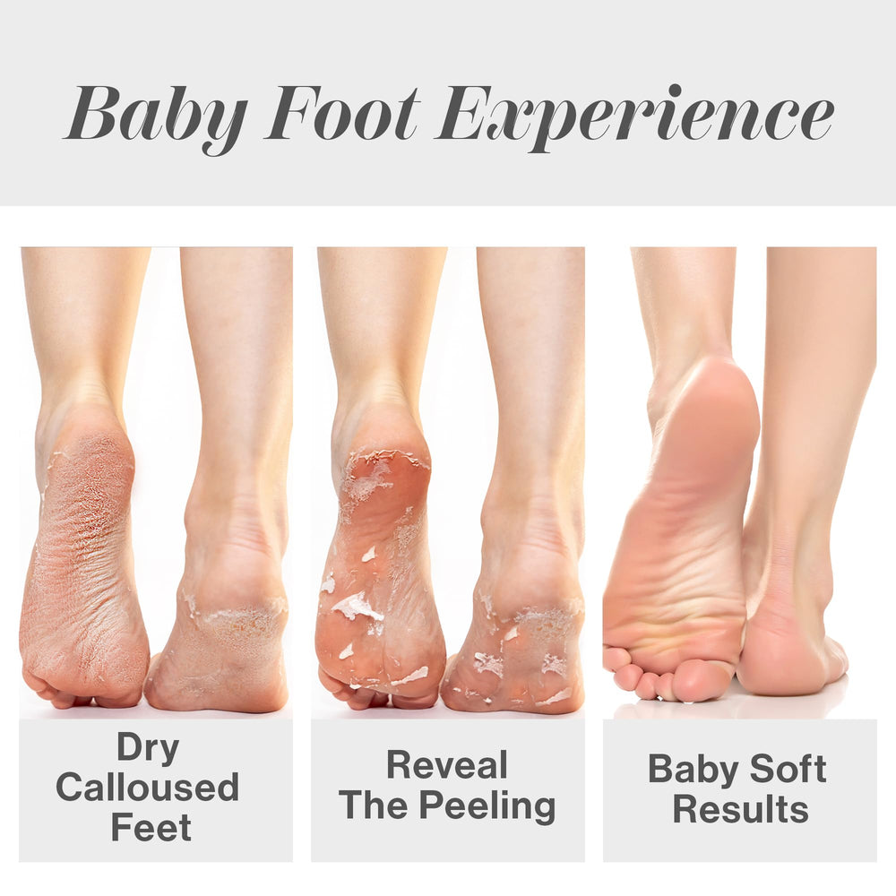 Baby Foot Original: tres simples pasos para un cuidado de pies cómodo.