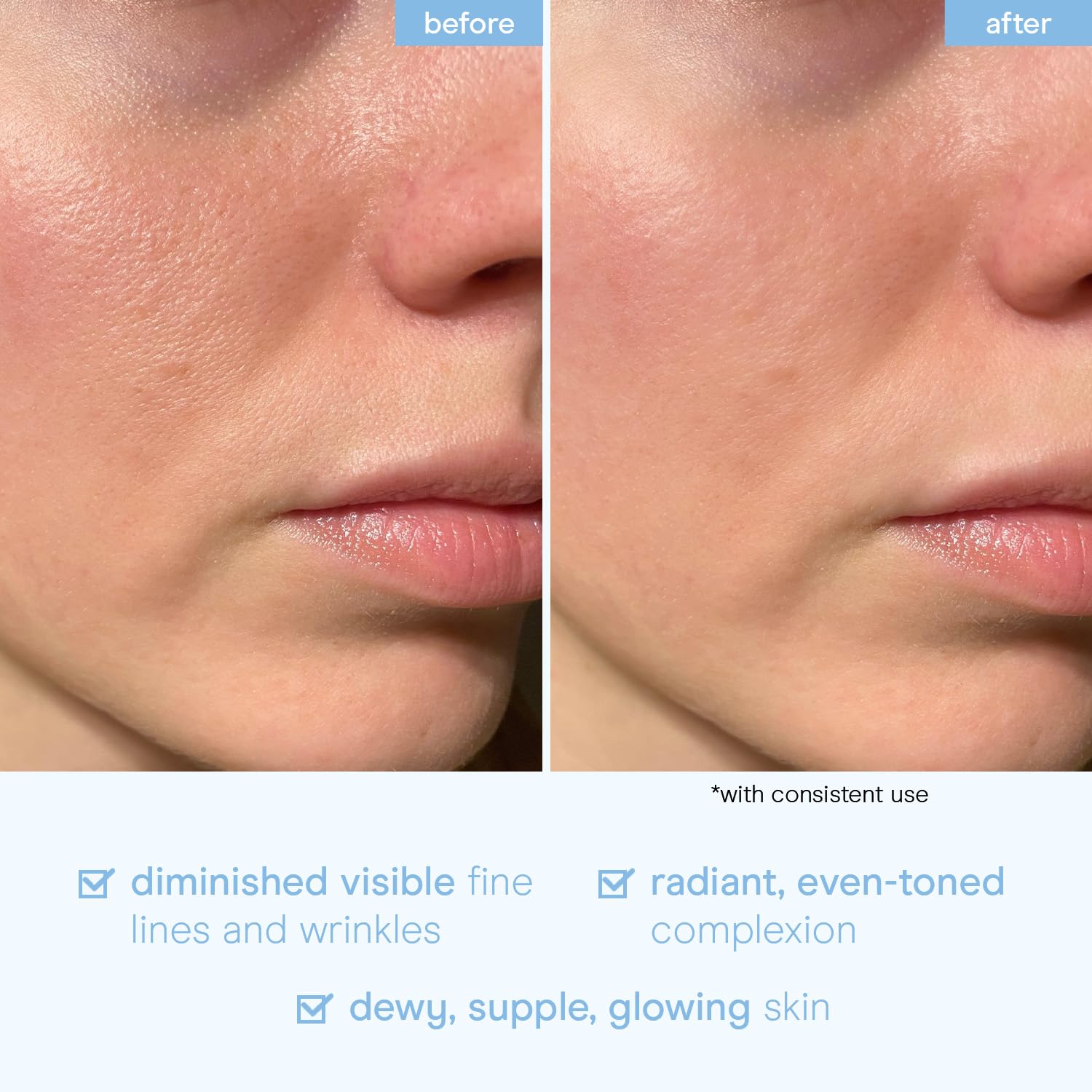 Baebody serum mucina de caracol, etiqueta muestra niacinamida y ácido hialurónico.