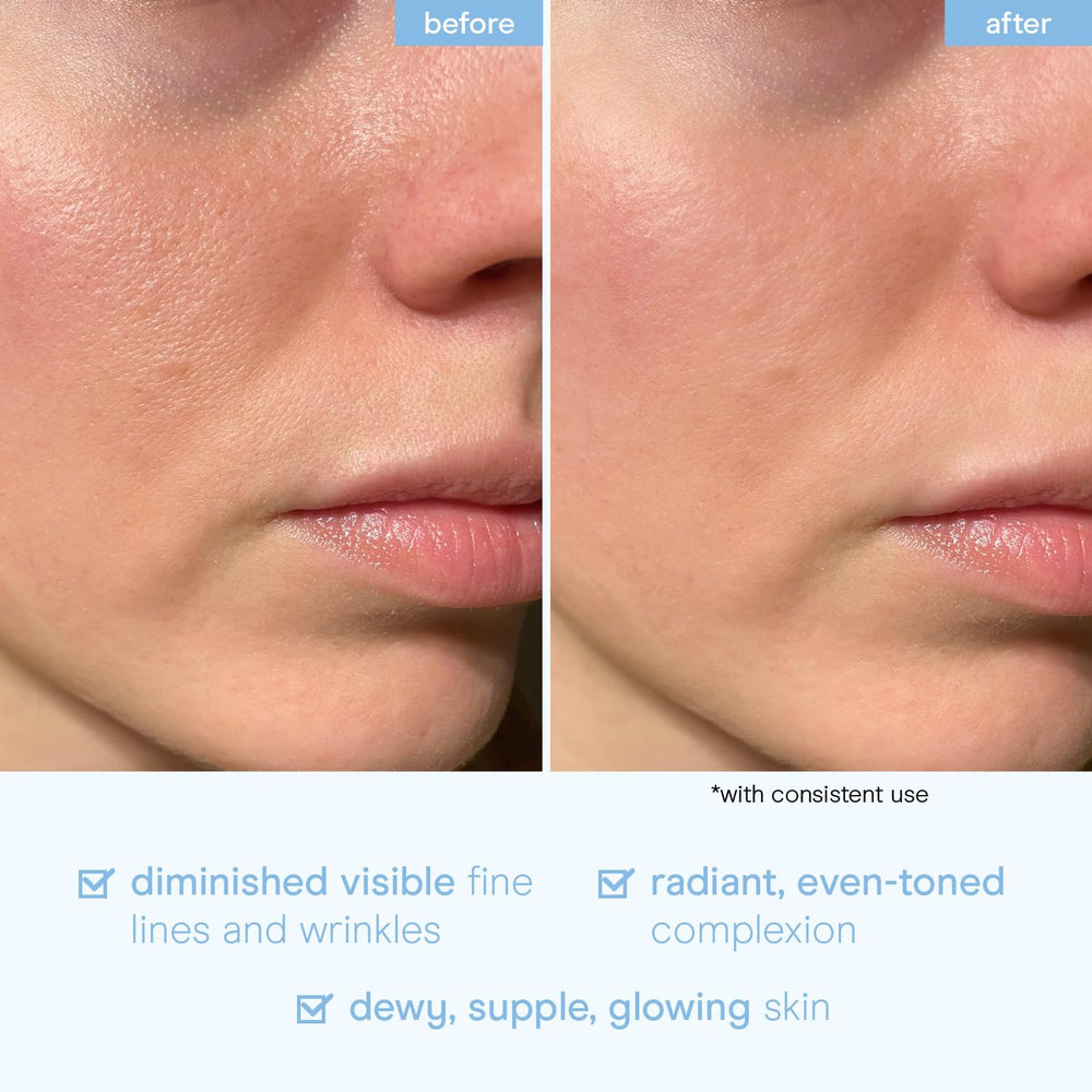 Baebody serum mucina de caracol, etiqueta muestra niacinamida y ácido hialurónico.