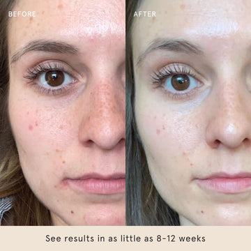 Barefaced loción refuerza la barrera cutánea con ceramidas para piel protegida.