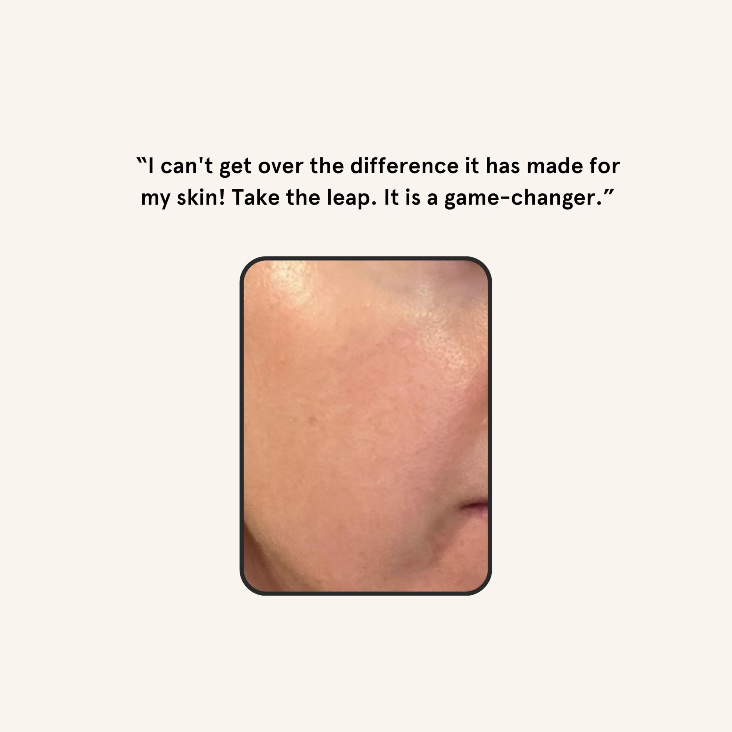 Piel más luminosa tras dermaplaning con Barefaced