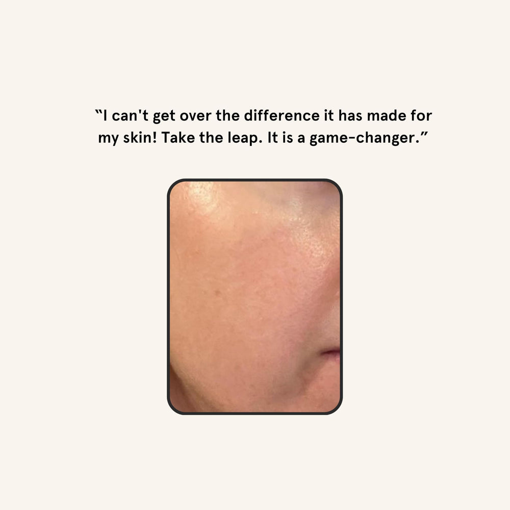 Piel más luminosa tras dermaplaning con Barefaced