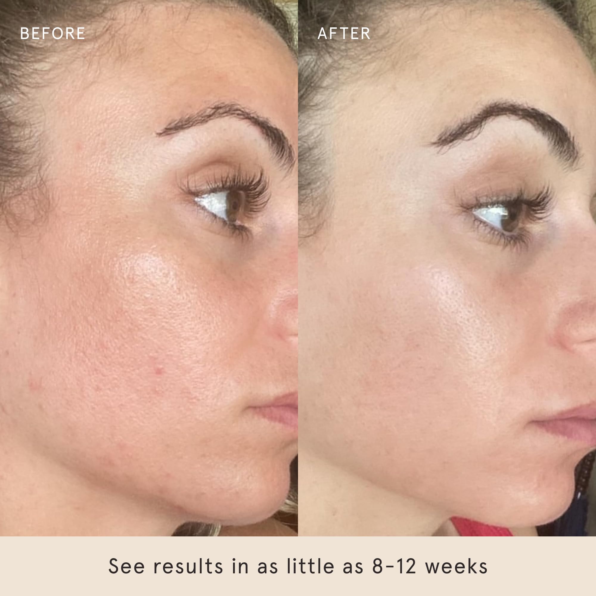 Barefaced Toning Pads preparan la piel para serums, mejor absorción.