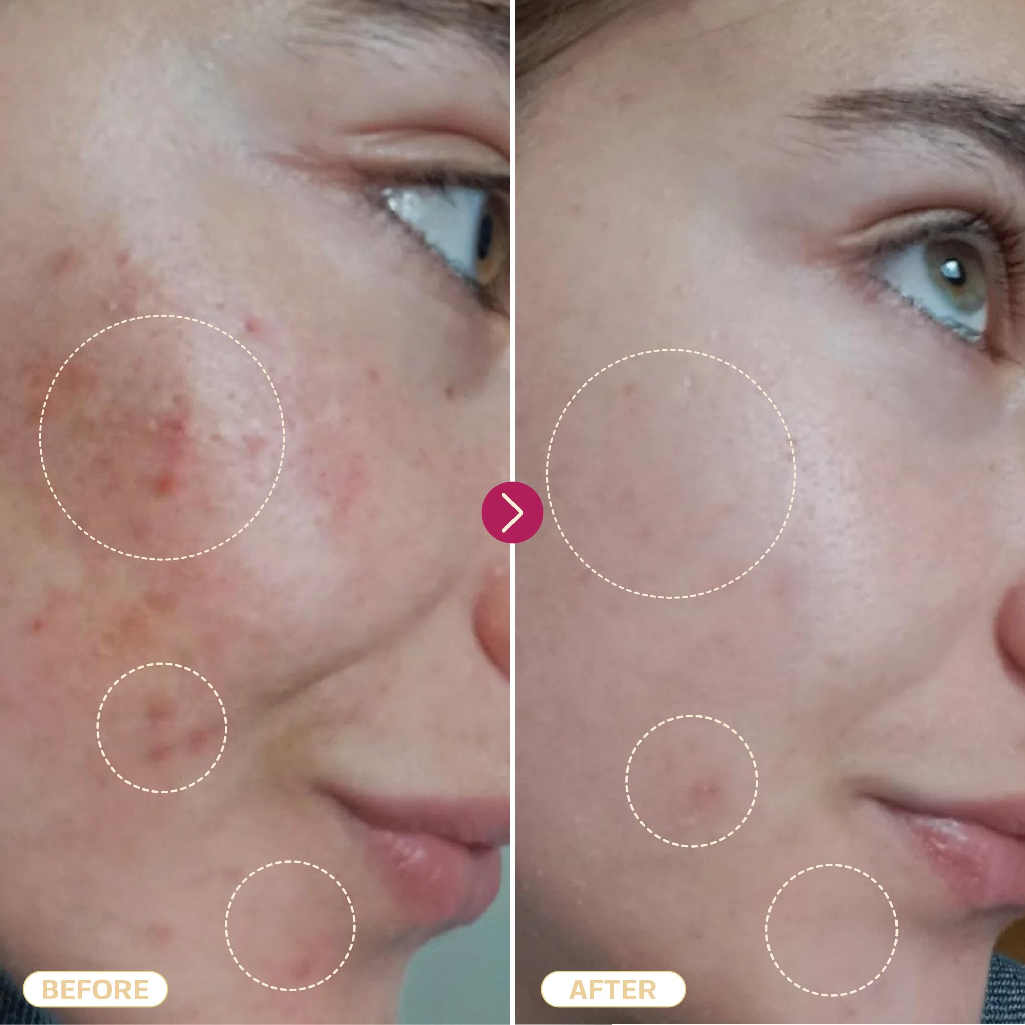 BASE LABORATORIES cuidado de piercings y heridas con HOCl suave